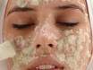PEELING, ANTIARRUGAS Y MANCHAS 