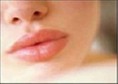 AUMENTO DE LABIOS 